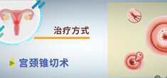 宫颈癌的手术治疗方式有哪些？术后可能会出现哪些并发症？